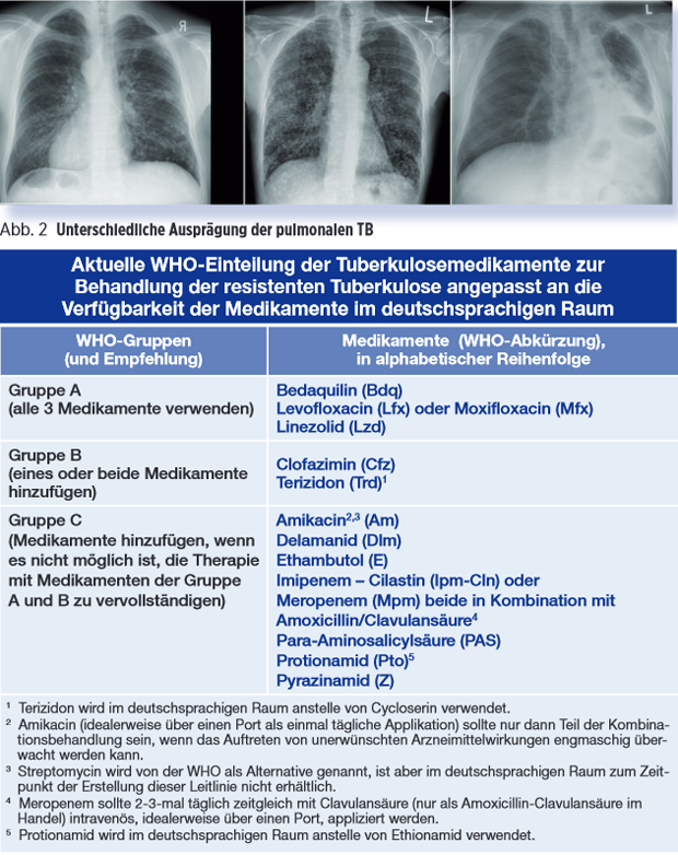 Unterschiedliche
      Ausprägungen