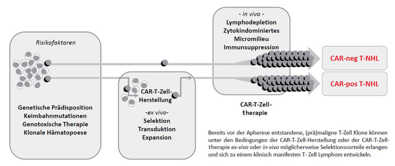 Abb. 1   Schematische Darstellung der Entstehung sekundärer T-Zell Lymphome nach CAR-T-Zelltherapie
