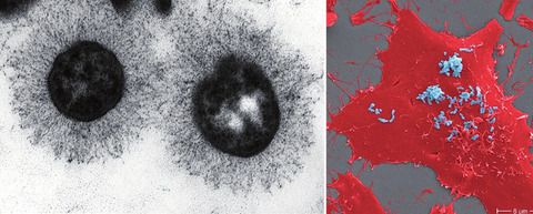 Abb. 1  Links: Bartonella henselaemit Expression des langen trimeren Autotransporteradhäsins BadA  Entnommen aus: Kaiser et al., 2011. Rechts: Mit B. henselae(blau) infizierte Endothelzellen (rot, Rasterelektronenmikroskopie). Entnommen aus: van Belkum et al., 2021