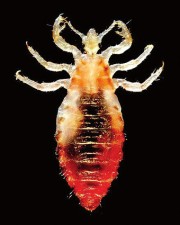 Abb. 2 Kleiderlaus nach Blutmahlzeit ©Wikipedia, aus der Public Health Image Library (PHIL