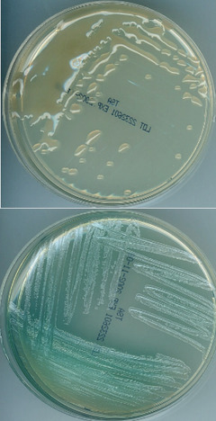 Abb. 1 a, b a Pseudomonas aeruginosa – muko- ider Phänotyp (Reinkultur) b Pseudomonas aerugi- nosa – non-mukoider Phänotyp (Reinkultur)