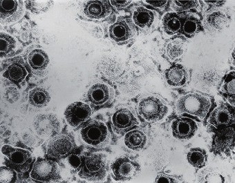 Spiegeleiform des Herpes-simplex -Virus im TEM © wikipedia.org