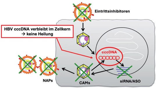 Abb. 1   Infizierte Leberzelle mit Viruspartikeln im Zytoplasma und der viralen cccDNA, die extrachromosomal im Zellkern vorliegt. Das Virus bietet in seinem Replikationszyklus, beginnend beim Eintritt in die Zelle, über die Replikation und Genexpression bis zum Zusammenbau und der Ausschleusung neuer Viruspartikel, verschiedene therapeutische Ansatzpunkte