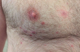 Bild Brust © Dr. Henning Klorikal